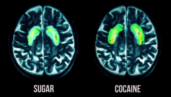 סוכר לעומת קוקאין: אותה תגובה מוחית, אבל יותר ממכר
